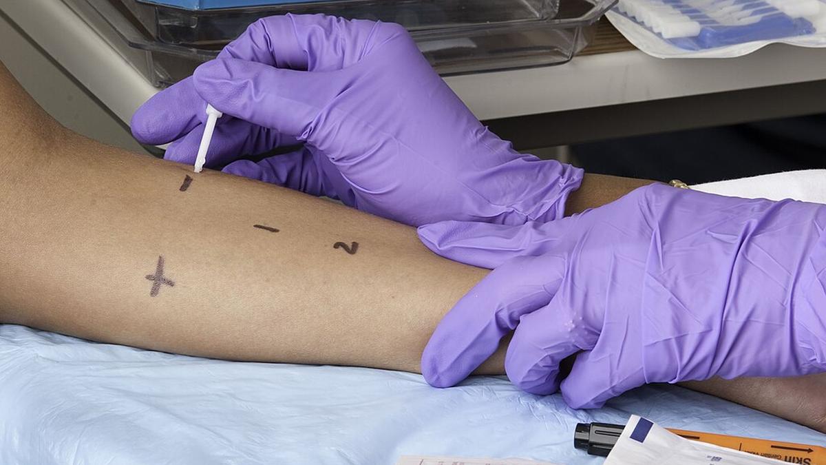 Allergies in children can manifest in different forms: how early identification and careful management can help
Premium