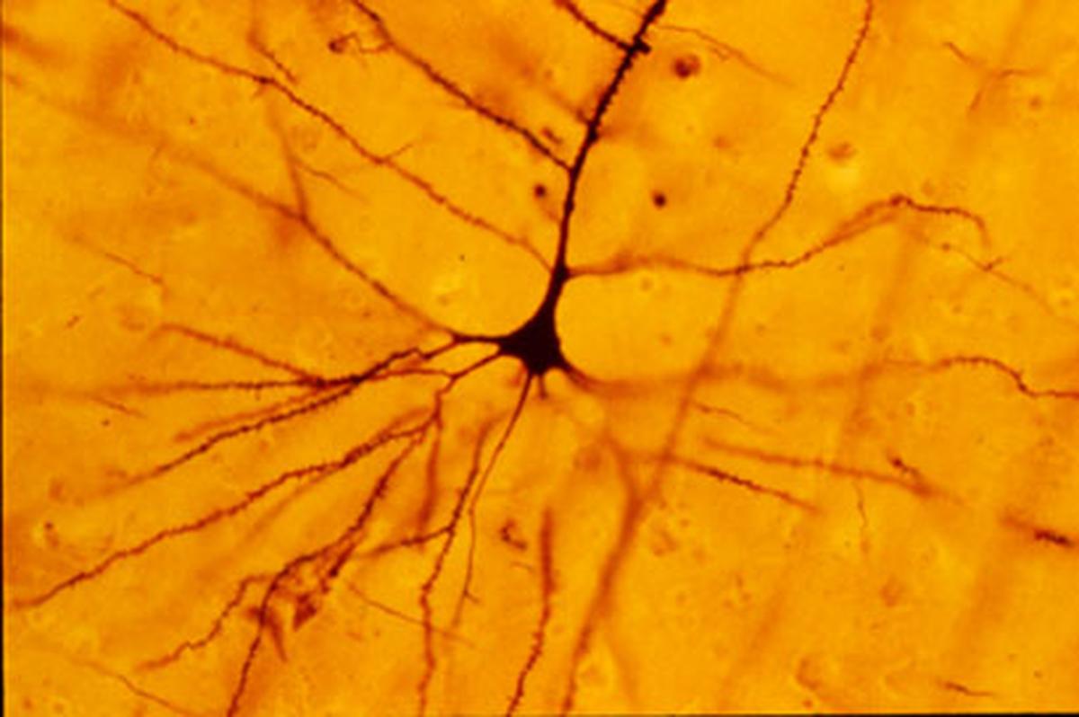 A human neocortical pyramidal neuron stained via Golgi technique A human neocortical pyramidal neuron stained via Golgi technique