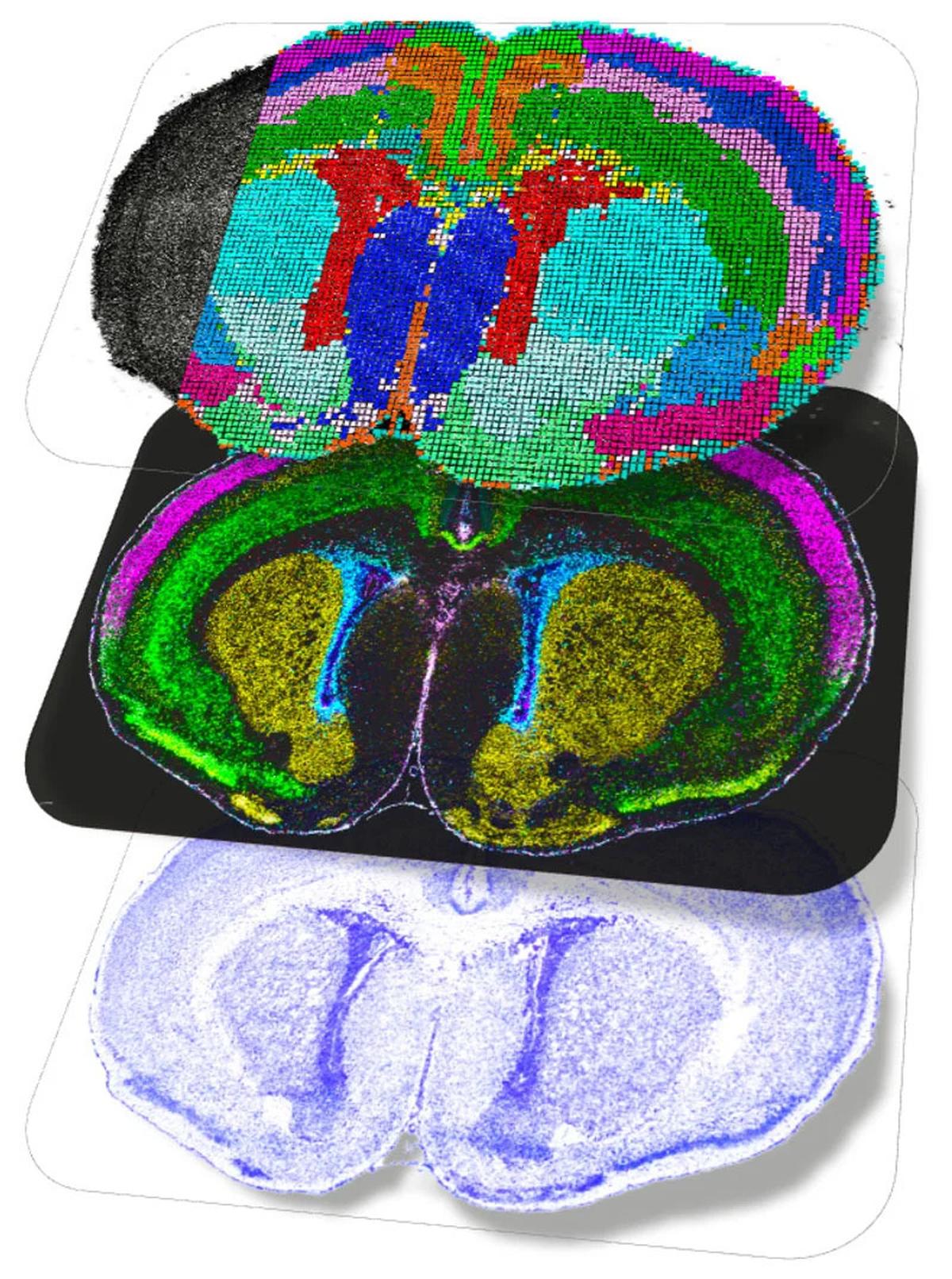 প্রসবোত্তর মাউস মস্তিষ্কের স্থানিক মাল্টিওমিক্স মানচিত্রগুলি কর্টিকাল স্তর নিউরন পরিপক্কতা এবং অলিগোডেনড্রোসাইট পার্থক্য এবং মেলিনেশন হাইলাইট করে। প্রসবোত্তর মাউস মস্তিষ্কের স্থানিক মাল্টিওমিক্স মানচিত্রগুলি কর্টিকাল স্তর নিউরন পরিপক্কতা এবং অলিগোডেনড্রোসাইট পার্থক্য এবং মেলিনেশন হাইলাইট করে।