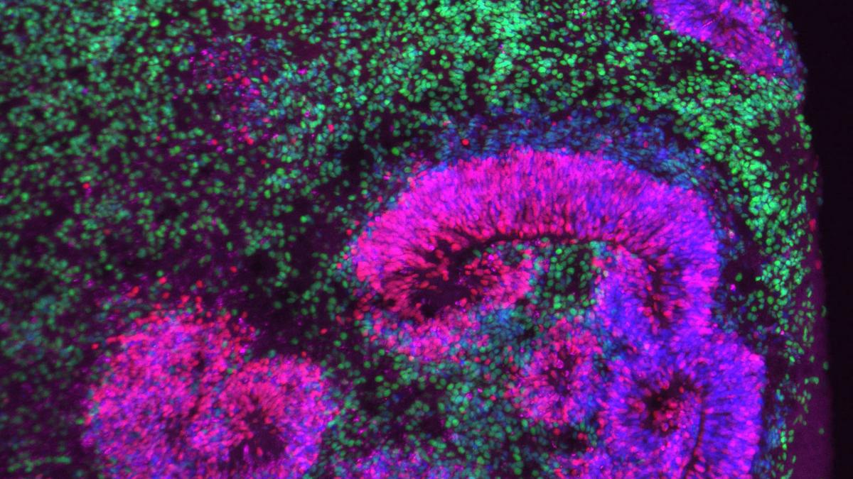 How groundbreaking new brain atlases capture development in motion
Premium