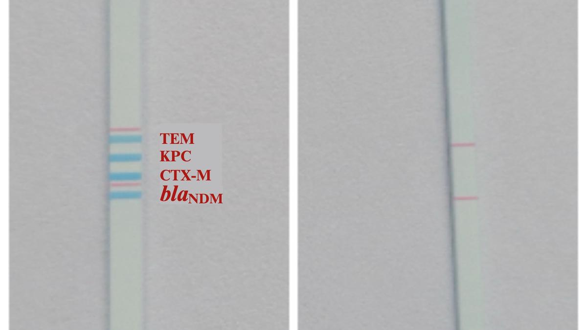 Indian scientists make affordable dipstick test to track AMR in sewage