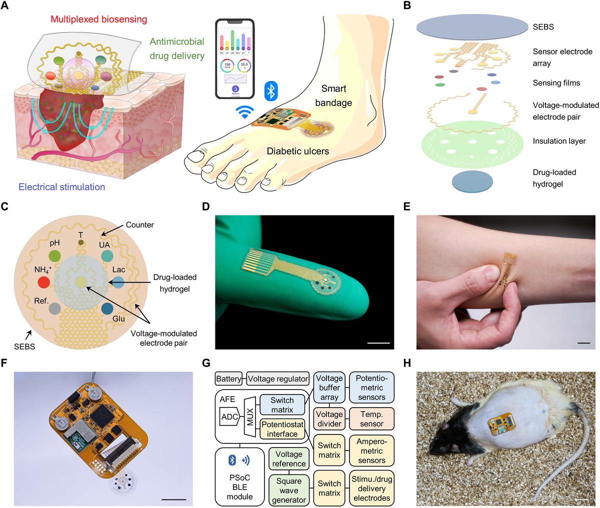 (A) Schematic of a soft wearable patch on an infected chronic wound on a diabetic foot. (B) Schematic of layer assembly of the wearable patch. (C) Schematic layout of the smart patch consisting of various sensors and electrodes. (D, E) The flexible wearable patch (scale bars 1 cm). (F, G) Schematic diagram (F) and photo (G) of the miniaturised wireless wearable patch. (H) Photo of the fully integrated patch on a diabetic rat with an open wound (scale bar 2 cm).