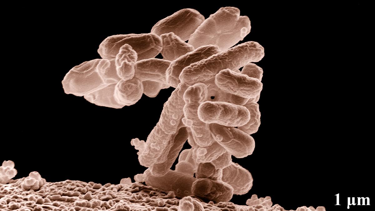 Nanoplastics can make E. coli infections worse: study
Premium
