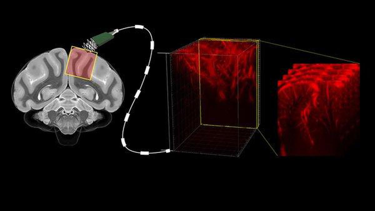 Best from science journals: Reading minds with ultrasound