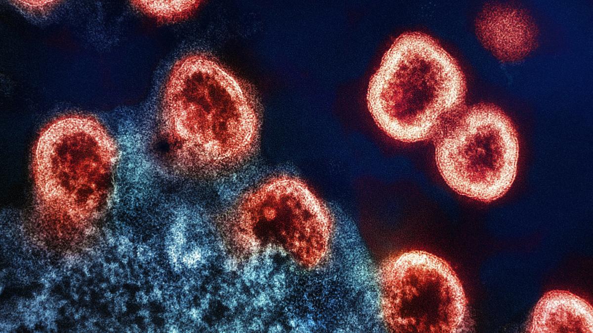 HIV strains in India resist some top broadly neutralising antibodies
Premium