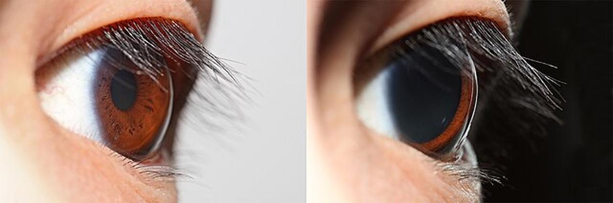 Views of an Asian male human eye, taken consecutively in well lit (left) and dim (right) environments to show the changes in pupil size. The pupil measured 3mm on the left and 9mm on the right.