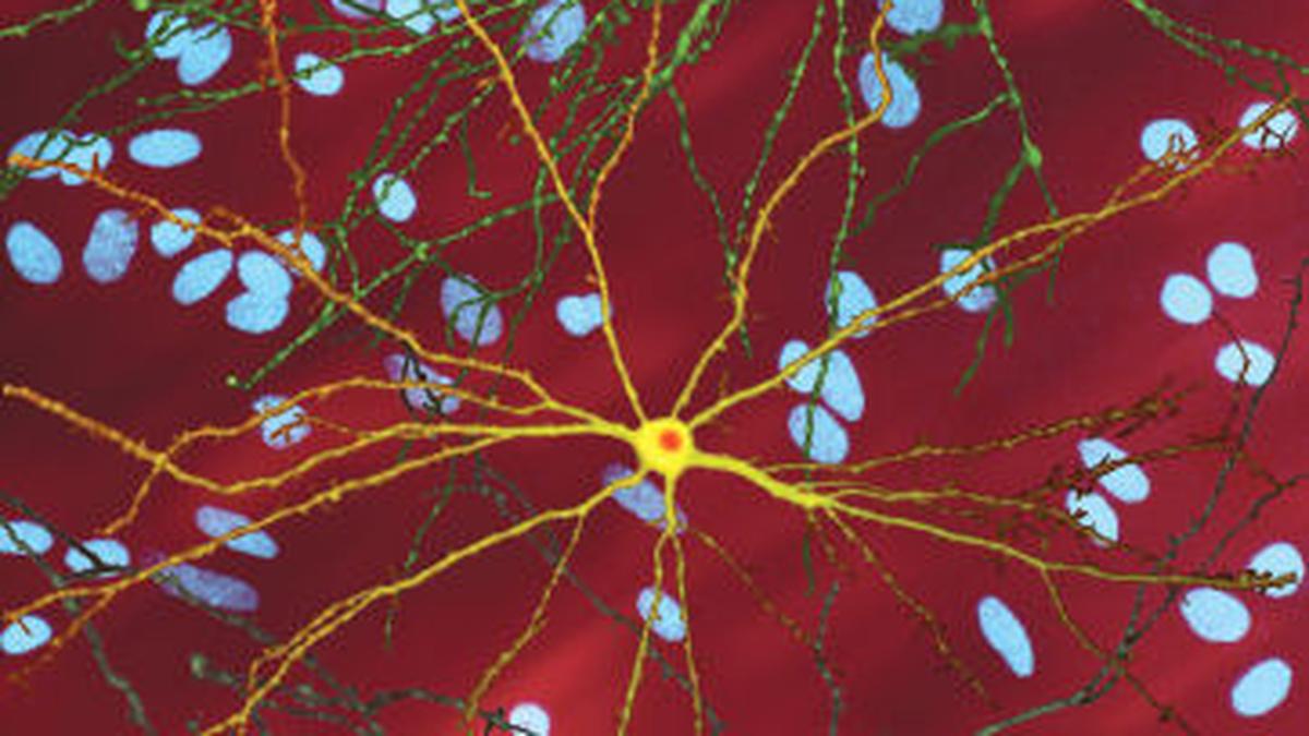 গবেষকরা, পরিবারগুলি ছন্দ এবং সংকল্পের সাথে হান্টিংটনের মুখোমুখি