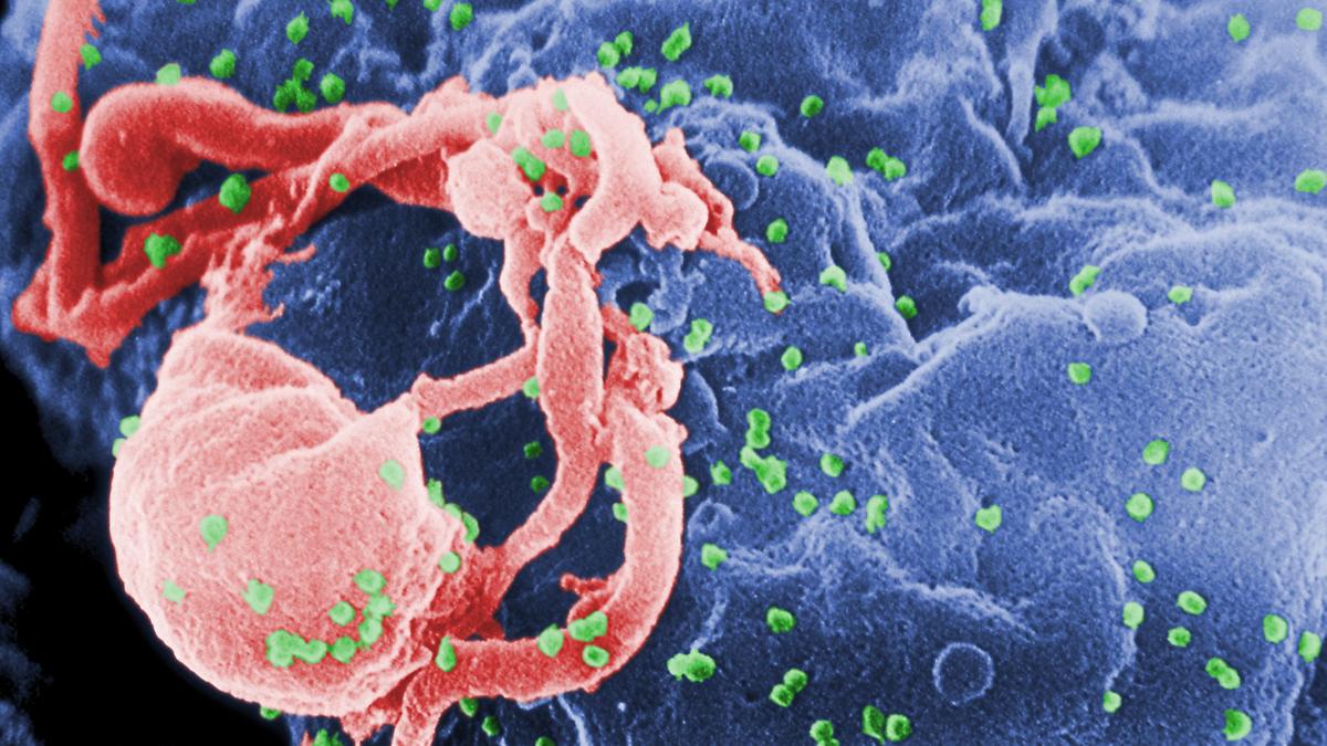 Quatre nouvelles études font état de progrès vers un vaccin anti-VIH tant attendu