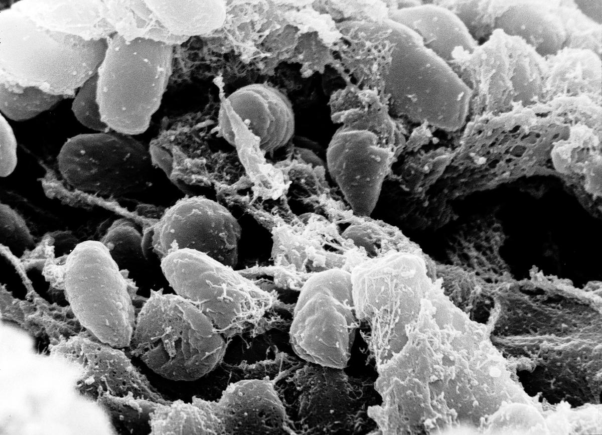 A scanning electron micrograph of Yersinia pestis bacteria in a flea.