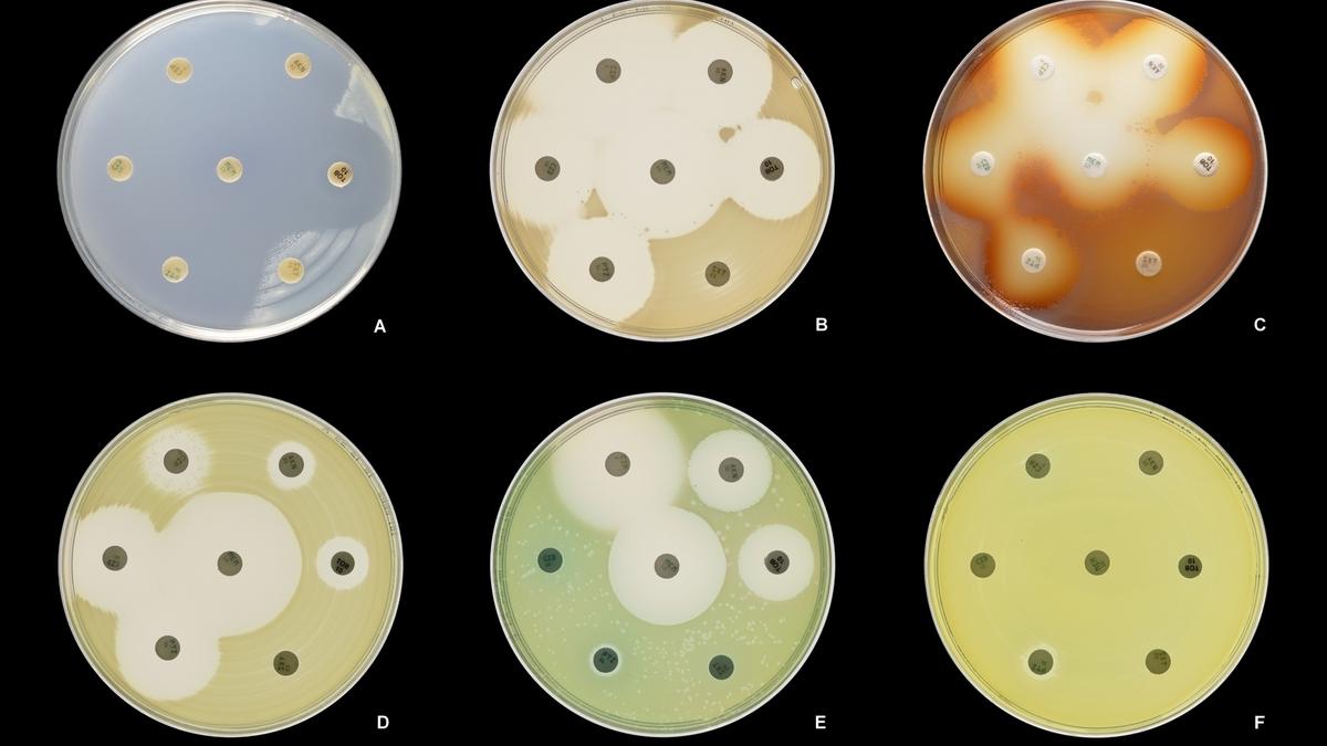 Gene Discovery Offers Hope in Fight Against Deadly Bacterial Infections