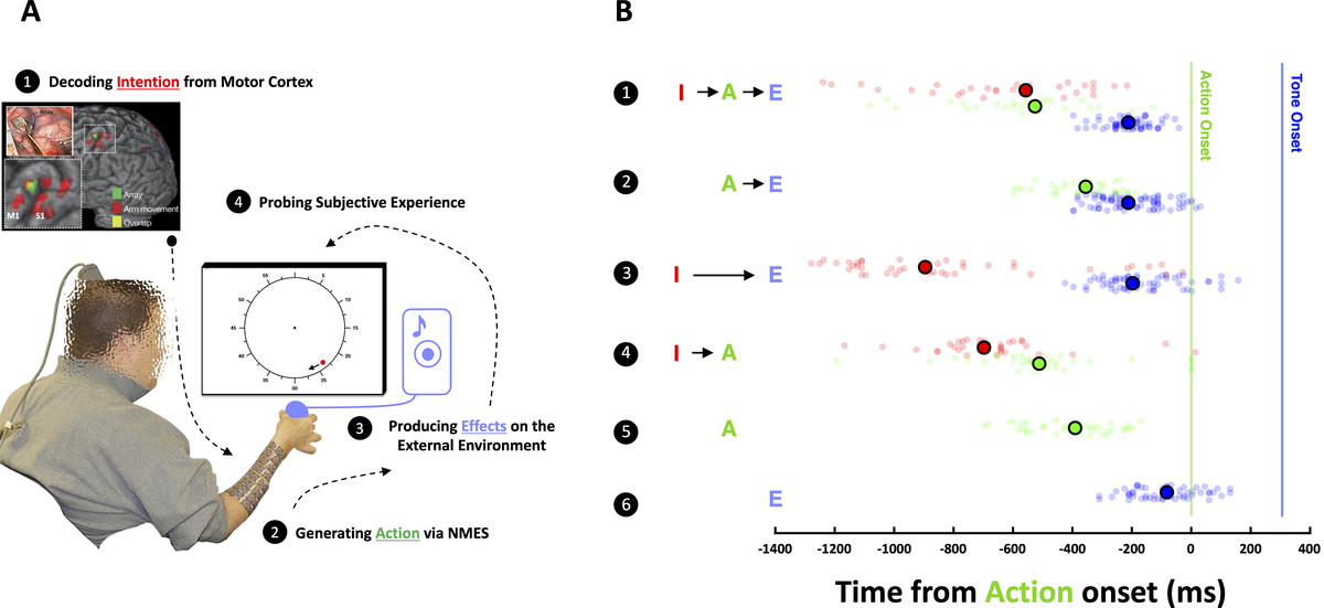 The neural recording and experimental setup (left). The behavioural responses are displayed on the right. Row 1: full intentional chain where the BMI user indicates time of intention (I, red), action (A, green), and an effect (E, blue) in the external environment. Row 2: estimates of the timing of actions and effects in the absence of intention. Row 3: estimates of the timing of intentions and effects in the absence of actions. Row 4: estimates of the timing of intentions and actions in the absence of an effect. Row 5: estimate of the timing of actions in the absence of intentions and effects. Row 6: estimate of the timing of effects in the absence of intentions and actions.