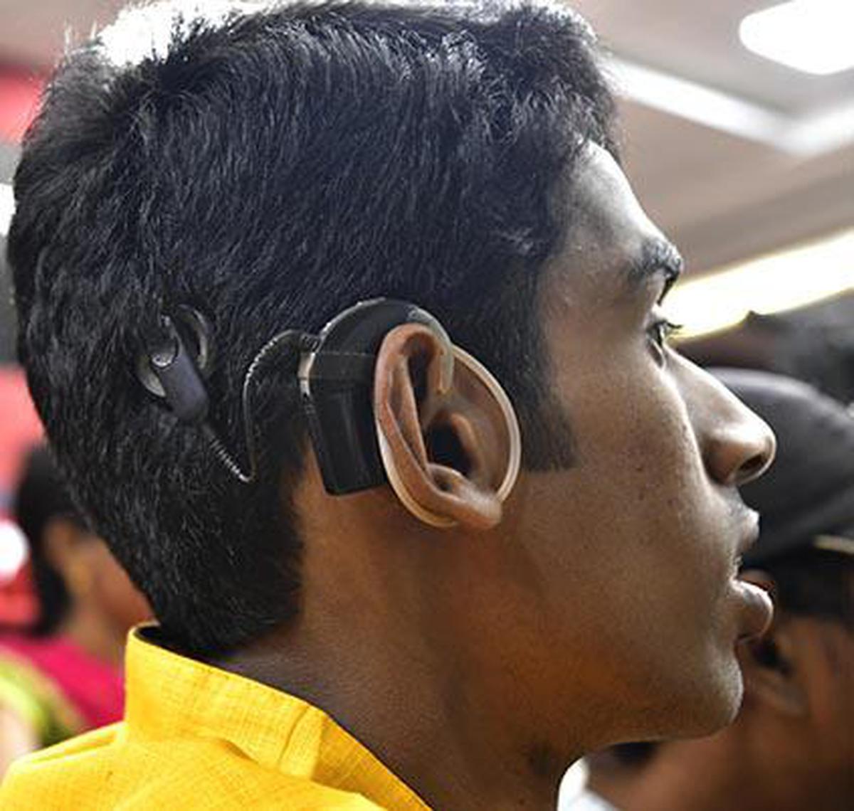 Free cochlear implants for 500 children afflicted by congenital hearing loss: Karnataka Health Minister